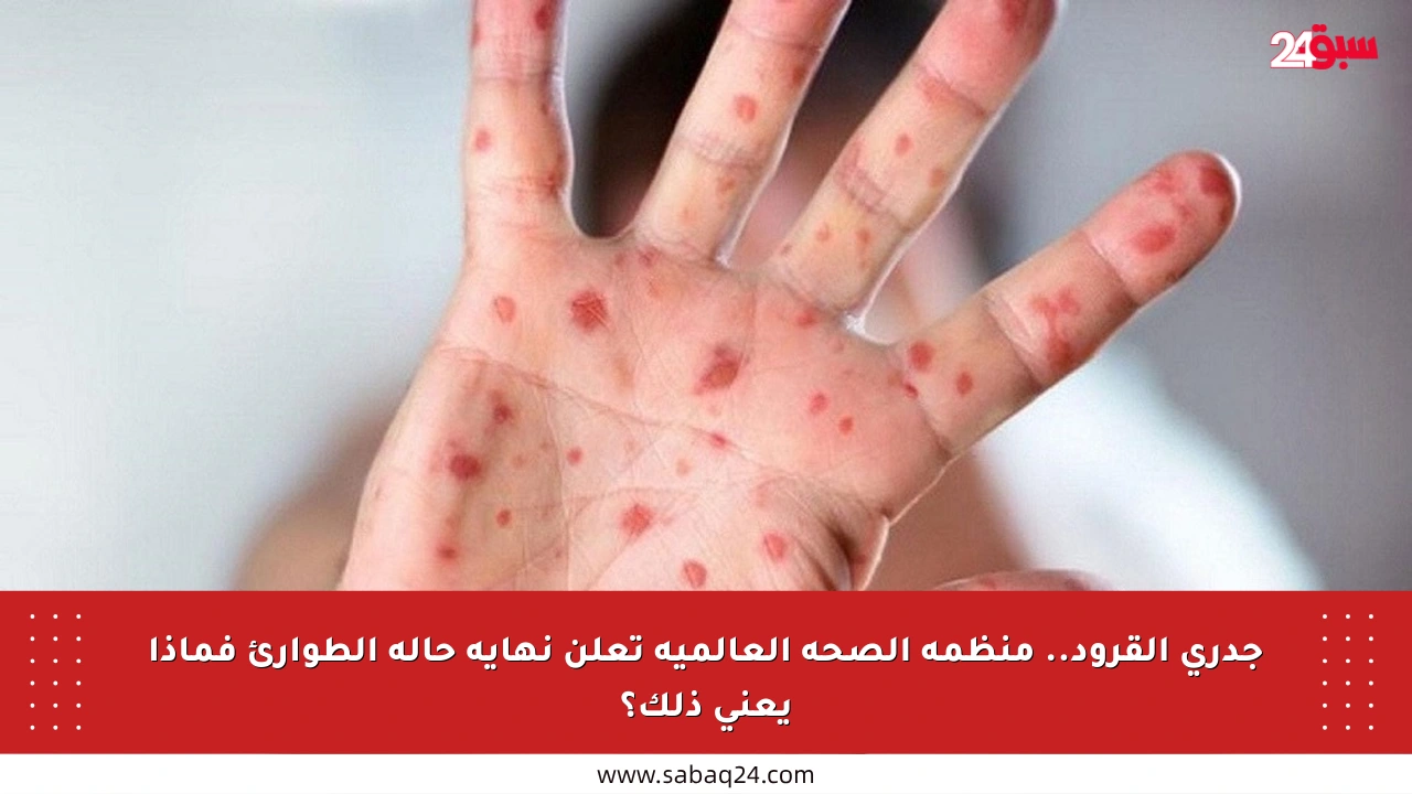 جدري القرود.. منظمة الصحة العالمية تعلن نهاية حالة الطوارئ فماذا يعني ذلك؟